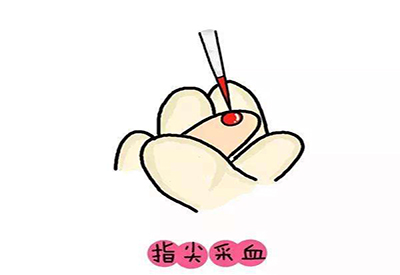 兒童草莓视频在线下载APP微量元素的檢測項目有哪些 兒童草莓视频在线下载APP微量元素的檢測項目有哪些