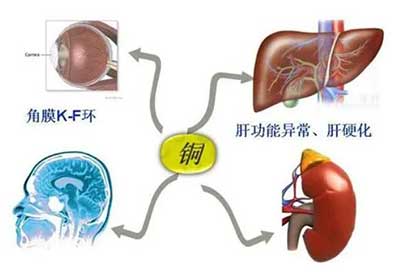 人體草莓视频官网污數據能夠準檢測出但身體中微量元素銅超標會引起疾病發生 人體草莓视频官网污數據能夠準檢測出但身體中微量元素銅超標會引起疾病發生